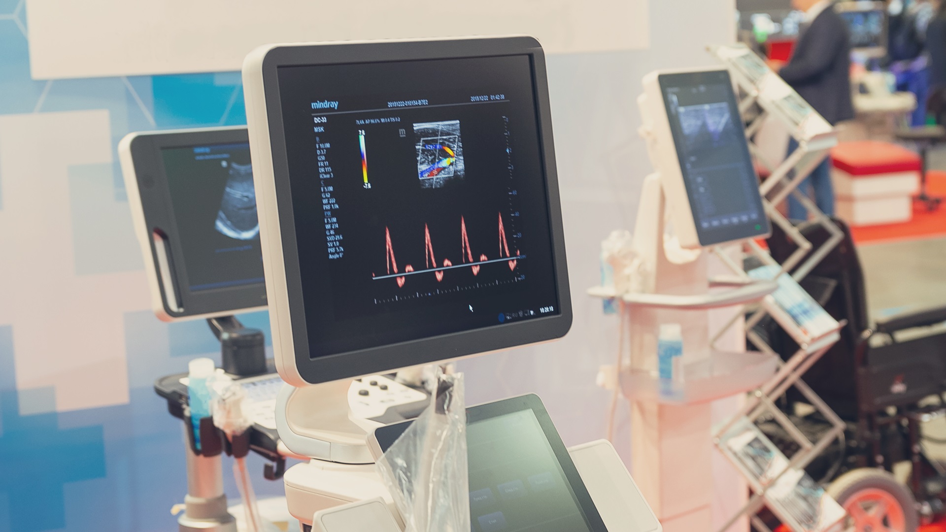 An ultrasound machine display showing a Doppler ultrasound image with measurement graphs, positioned at a medical equipment exhibition booth.